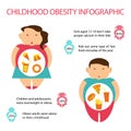 Childhood Obesity Infographic.